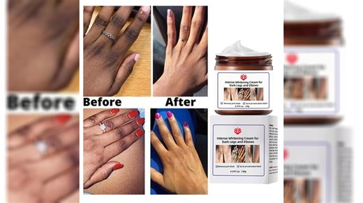 Private Label Dark Inner Thighs Cream Bikini Area Brightening Whitening Body Cream