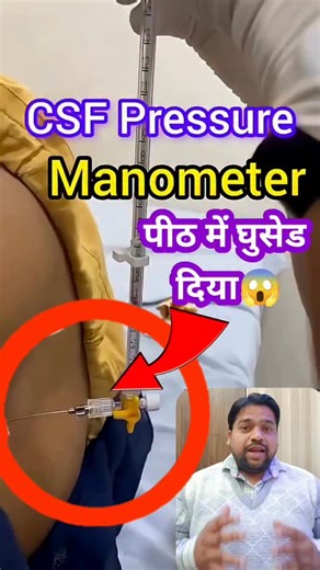 Dr Medicare Help on Instagram: "CSF Pressure manometer #neet #shorts #viralshorts #hospital #doctor"