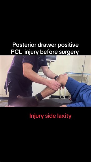 Understanding PCL Reconstruction: Key Insights