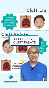 7.9K views · 120 reactions | Next up for our focus on GI disorders in...