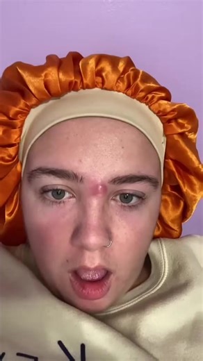 1.3K views | Let's Clean Up 2025  (9) | Pimple Popper | Facebook