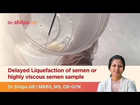 Delayed Liquefaction of semen or highly viscous semen sample | Dr Shilpa GB