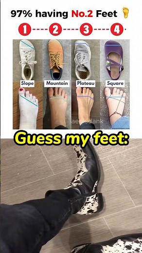 You Can’t Escape 🦶😂