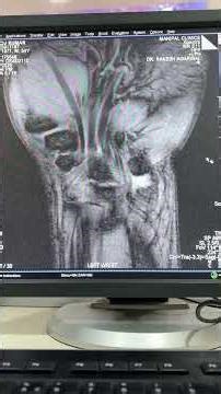 MRI WRIST JOINT #ytshorts #shorts #shortsfeed #shortvideo #trending