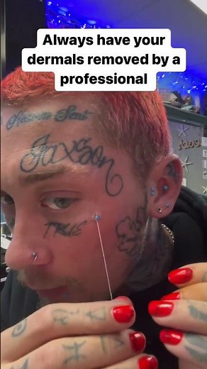 This is absolutely not how to remove a dermal piercing and trust me it’s extremely painful and I do