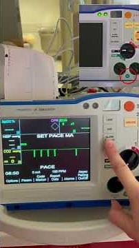 Pacer Check for Zoll R Series Defibrillator