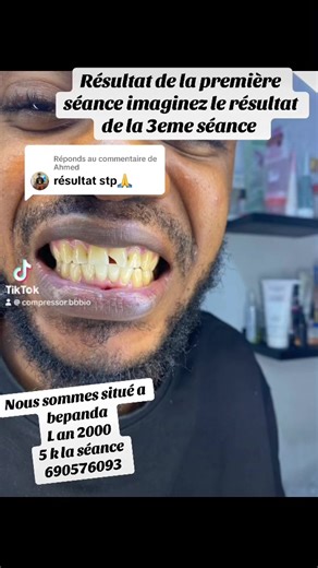 Réponse à @Ahmed #CapCut #FYP #cejour #bepanda #blanchimentdentaire #InstitutDeBeauté #CapCut #DoualaBeauté #africantiktok #toutlemonde🌍 #toutlemonde