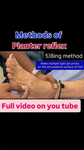 DrRajbali on Instagram: "Methods of planter reflex #bhopal #medicine #nurse #trendingreels #mbbs #doctor #hospital #examination #planterreflex #neuro #bhms #babinski"