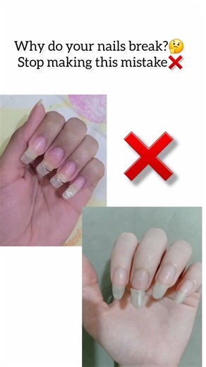 why your nails break ? stop doing this mistake #nailcare #longnails #shortvideo #shorts #shortsfeed