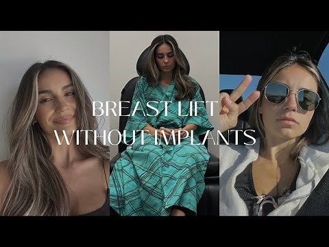 BREAST LIFT WITHOUT IMPLANTS | cost, why I didn't get implants, pre-op
