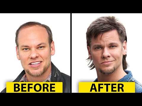 Theo Von's Hair Transplant | Plastic Surgery Analysis