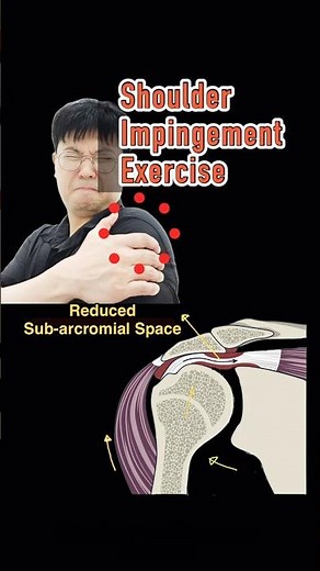 Shoulder Impingement Exercise. Clicking Shoulder. Reduce Shoulder Popping Sound.