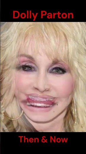 Dolly Parton then and now #countrymusic #dolly #dollywood