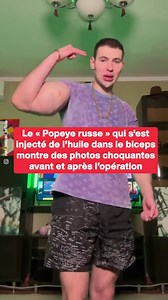 153K views · 392 reactions | Le « Popeye russe » qui s'est injecté de l'huile dans le biceps montre des photos choquantes avant et après l'opération | Le Tribunal Du Net | Facebook