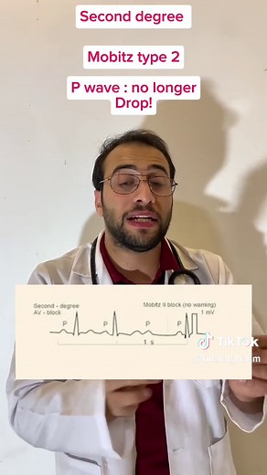 Understanding Heart Conduction Block: Mobitz 1 vs. Mobitz 2 on ECG