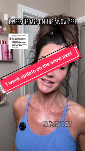 1 Week Post-Curenex Snow Peel: Skin Update