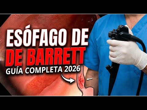Barrett's Esophagus: What It Is, Symptoms, Diagnosis and Treatment | Complete Medical Guide 2026