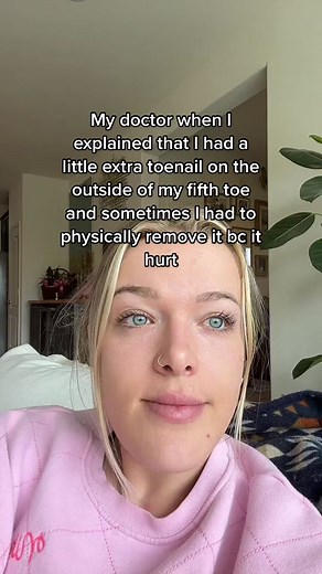 accessory nail of the fifth toe, also known as petaloid toenail, is a physical trait of the small toe, where a minuscule