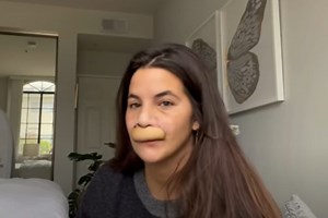 Após ataque de pitbull, modelo mostra resultado de cirurgia na boca