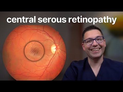 Central Serous Retinopathy: What You Need to Know