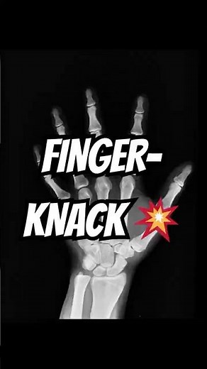 Warum Finger knacken 😳 Das steckt wirklich dahinter!