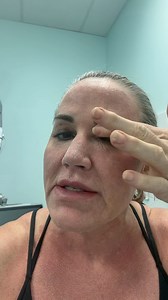Long Video but worth it! Follow Along with me as I get a Helix CO 2 Laser Resurfacing Treatment! This is more of an educational videos and what to expect. Later I will post my recovery of the treatment and in a couple months the before and after! Follow along! Tamara Mcmillan @laser_lovin_w_austin @ignitecartessa @cool_peel @cartessaaesthetics @chronos.exocr | Timeless Reflection