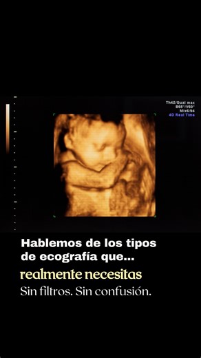 Mauricio Gómez Bossa | Medicina Maternofetal on Instagram: "¿Y los famosos “7D” u “8D”? 👀🤰 👉 Son simplemente filtros o mejoras de imagen. No son nuevos tipos de ultrasonido ni estudios médicos diferentes. Lo importante no es el nombre popular, sino qué se evalúa y quién lo interpreta 🩺 Porque cuando se trata de tu bebé, la información clara también es cuidado. 👉 Comparte esta información con esa embarazada que está a pocos días de realizarse su ecografía. #eco4d #embarazodealtoriesgo #peri