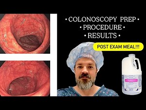 Colonoscopy Prep, Procedure, & Post-Exam Meal | Colyte Laxative (Gavilyte-C) Reaction | Colon Exam