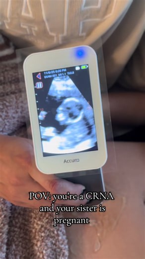 Grateful for these moments. Having so much fun with the Rivanna Accuro portable ultrasound. #medicine #ultrasound #anesthesia #md #crna #baby Consent received from my sister to post this. @Lynnette