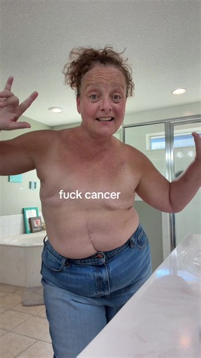 Fuck cancer ! I battled stage 4 Ovarian. I also have the BRCA 1 gene mutation. This mutation increases your risk significantly for breast and ovarian cancers. I didn’t know before I was diagnosed with cancer. I was able to protect myself against breast cancer that is why I had a double mastectomy and have no boobs. Get tested! #fyp #cancersurvivor #ovariancancer #brca #doublemastectomy