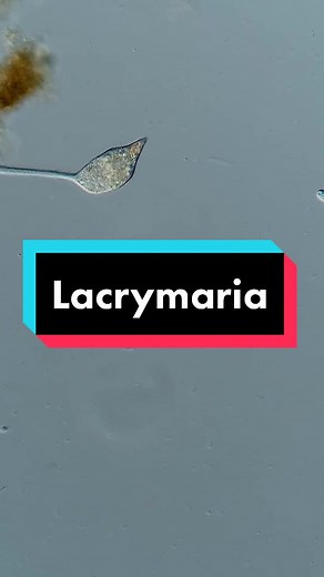 Lacrymaria #wtf #fyp