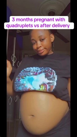 Journey Through Quadruplet Pregnancy and Delivery