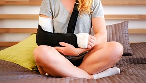 Ask the Doctors: Severity of broken bone determines whether surgery is needed