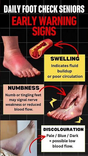 OVER 60? LOOK FOR THESE EARLY WARNING SIGNS | SWOLLEN FEET