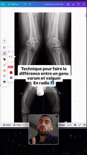 3K views · 700 reactions |  Commente “METHODE” pour recevoir...