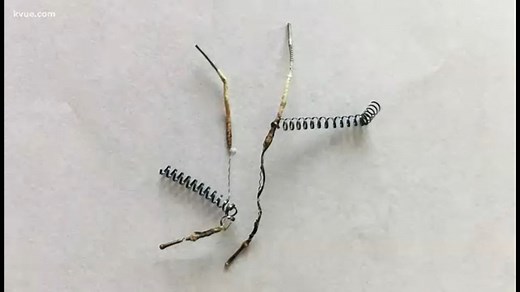 Essure, controversial permanent birth control device, being discontinued in U.S.