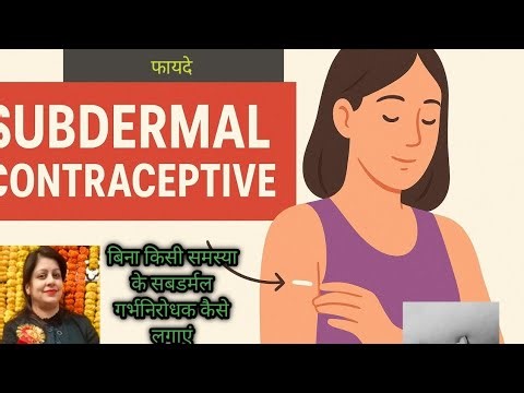 #Subdermal contraceptive insertion full information #