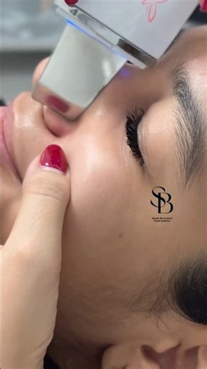 😱Satisfying Acne Extraction You Can’t Stop Watching 👀✨ #shorts