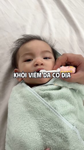 12K views · 67 reactions | Đây là kinh nghiệm của mình￼ đã giúp Tiểu An khỏi viêm da. Các mom áp dụng thử xem nha #tieuan #embetieuan #vdcd#viemdacodia #chamsua | Đỗ Hà An | Facebook