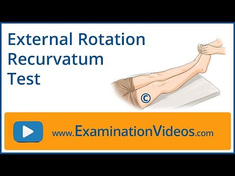 External Rotation Recurvatum Test
