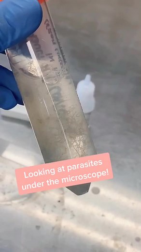 Exploring Parasites Under the Microscope