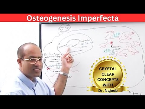 Osteogenesis Imperfecta & Its Types | Pathology