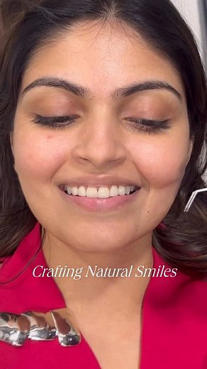 Comment “Yes” to know more about smile designing and porcelain veneers 🦷Veneers are a fully customised treatment, so costs can vary. We recommend a consultation with Dr. Ridhii to assess your needs. Crafting confident smiles—one veneer at a time! 🫶🏻✨⭐️ DM us to know more [veneers, porcelain veneers, smile designing, smile transformation, latest technology, crafting smiles, confidence booster, self care, cosmetic dentistry, dentistry, dental clinic, Dr Ridhit, pearly whites, teeth, dental heal