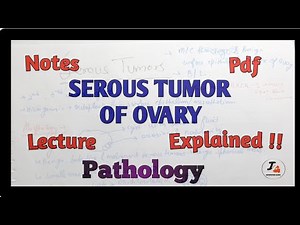 Serous Tumor of Ovary Pathology
