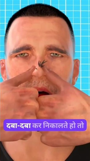 “Stop Ruining Your Skin! 🔥 | The Ultimate Blackhead Steam Hack