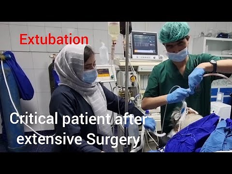Extubation' how to extubate critical patient after extensive Surgery without complications.