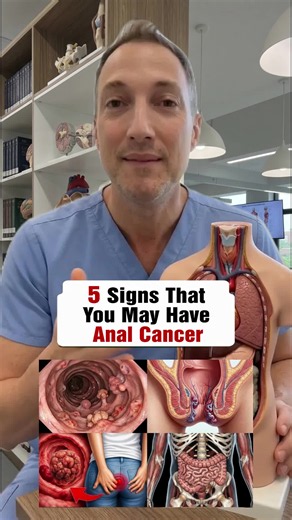 5 signs that you have anal cancer. #Health #HealthTips #HealthyLiving #HealthTip