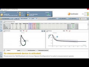 กราฟกลับด้านแก้ไขอย่างไร Vyntus Spiro V.2.21