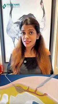 Pilonidal Sinus vs Boil: The Hidden Truth Behind That Painful Lump Near Your Tailbone