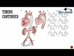 Med Trans IABP Just in time Traning IABP V3 1